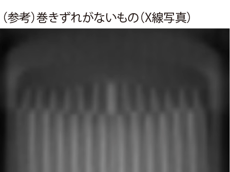（参考）巻きずれがないもの（X線写真）